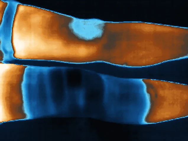 Thermal image of two legs at the knee: below, where the soaked bandage was, cooler (blue); above, without a bandage, warmer